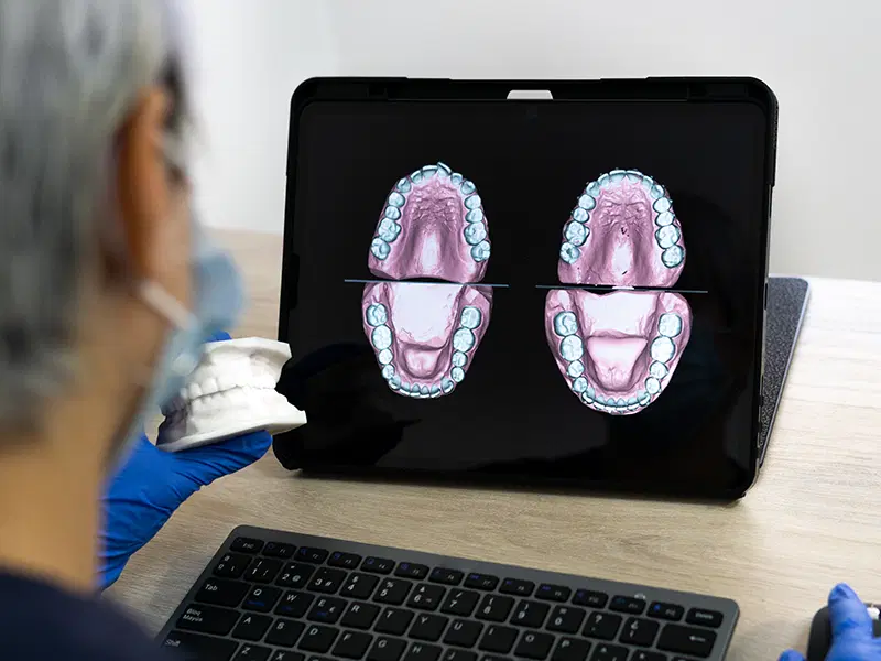 Software de diseño digital dental