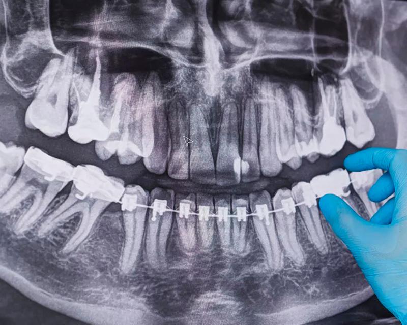 Equipo de radiología dental 2D