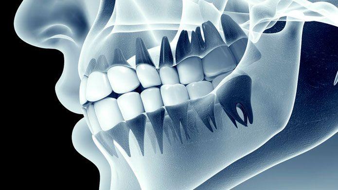 Equipo de radiología dental 3D CBCT