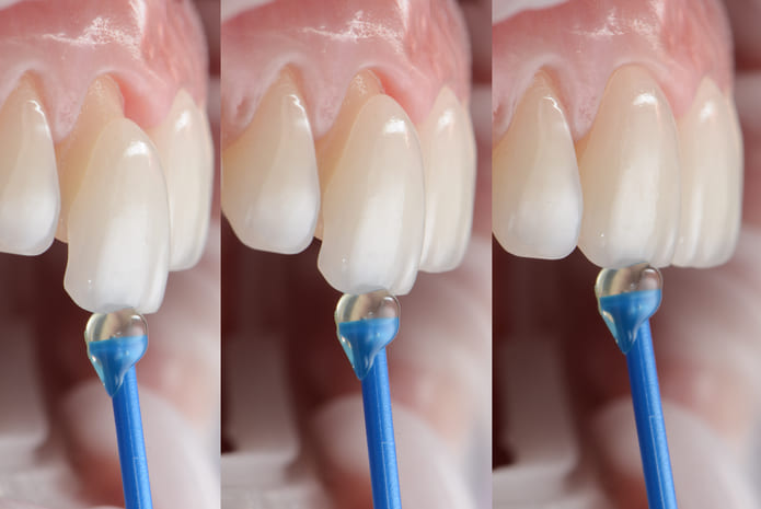 Servicios dentales