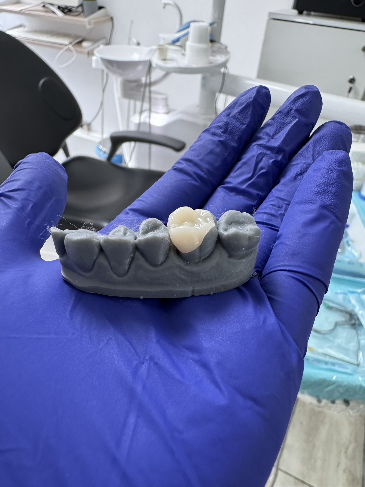 Rehabilitación oral