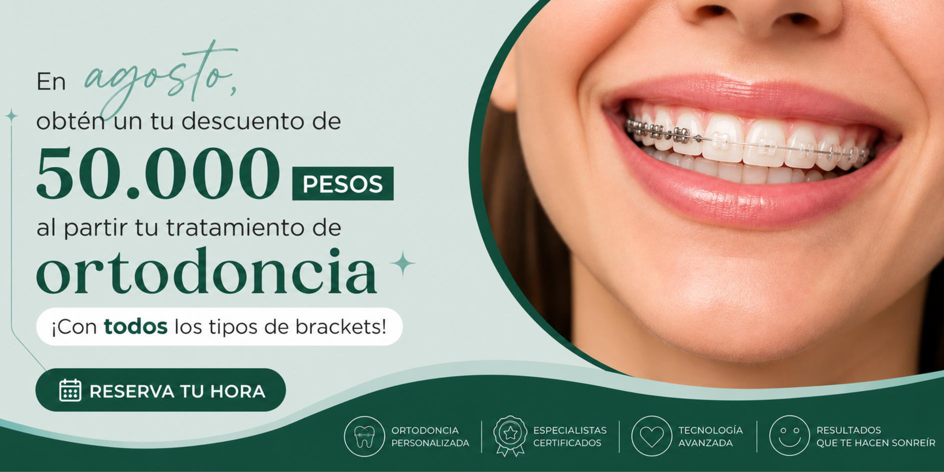 Ortodoncia con todos los tipos de brackets